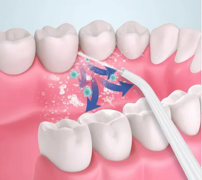 3 In 1 Oral Irrigator